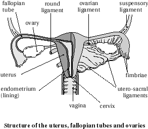 endometriosis